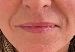 A close up of a woman 's face with wrinkles and pink lips.