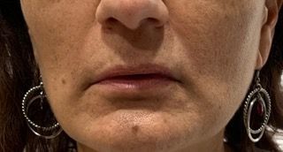 A close up of a woman 's face with earrings on.