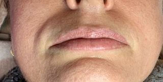 A close up of a woman 's lips and nose.