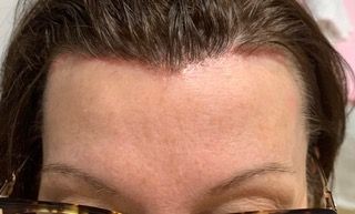 A close up of a woman 's forehead with glasses on.