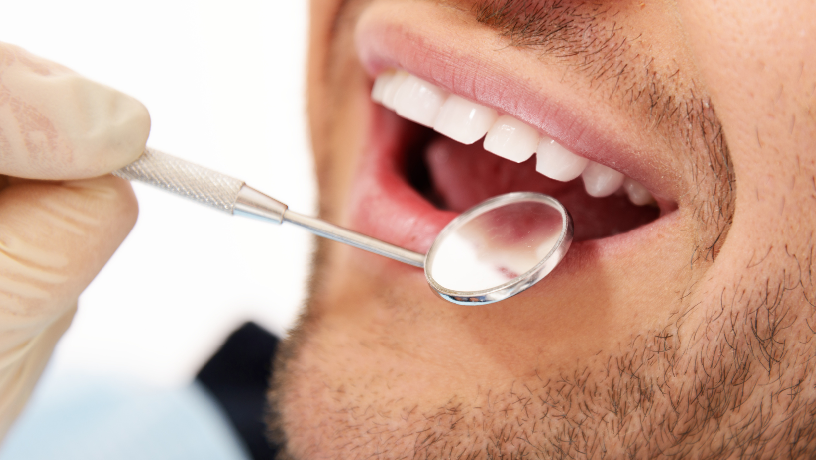 teeth-cleaning
