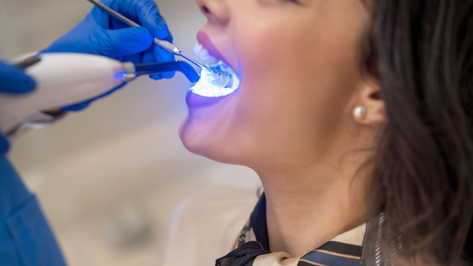a woman is getting her teeth whitened by a dentist