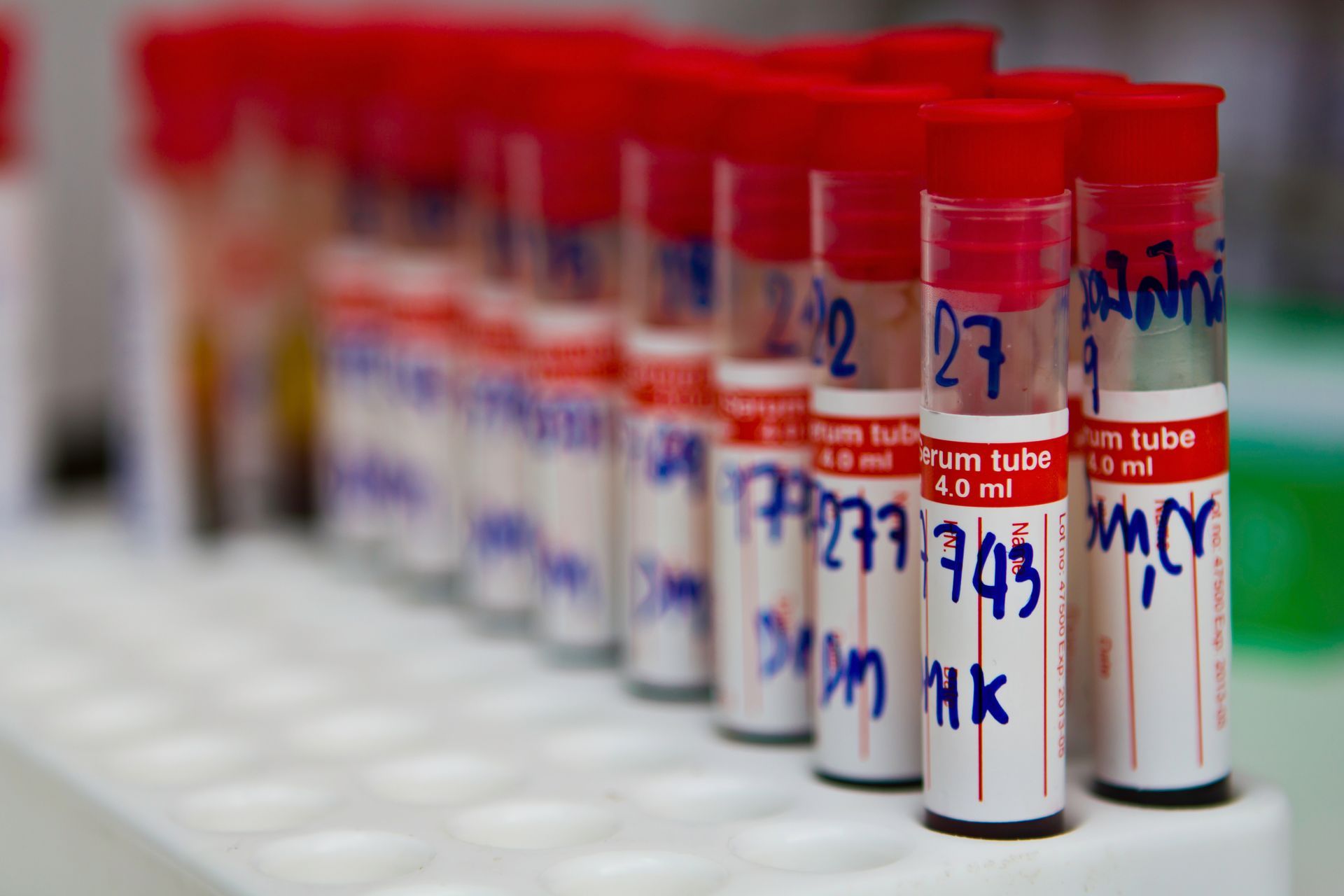 A rack of medical blood collection tubes with red caps and handwritten labels, arranged in a laboratory setting.