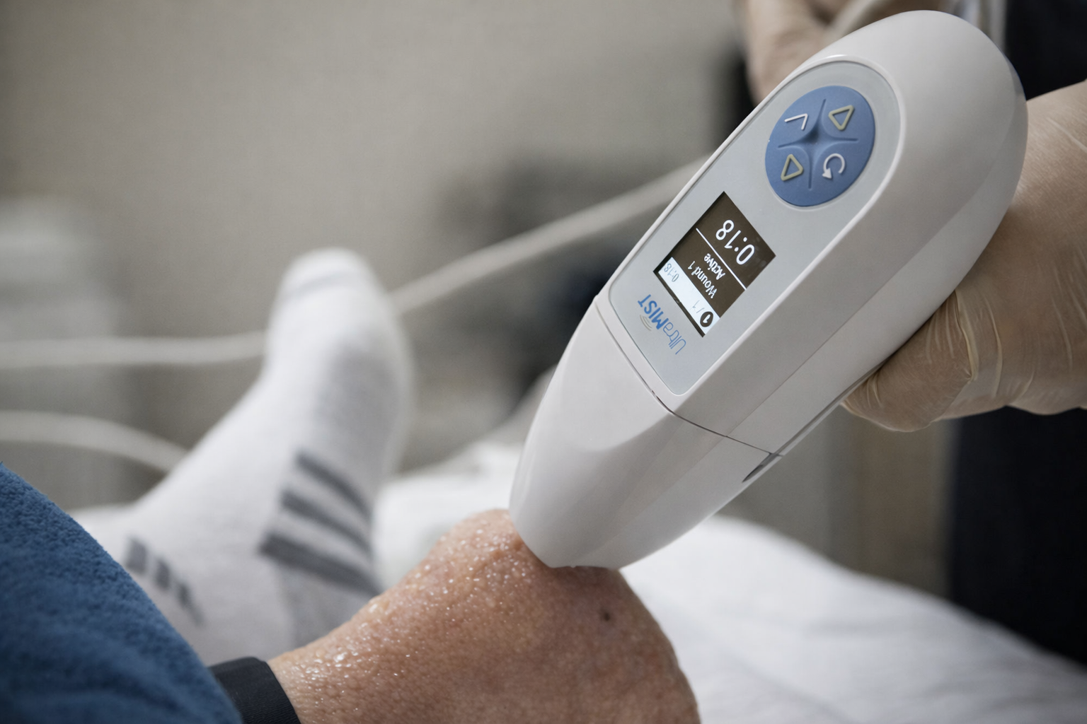 A gloved hand uses a handheld medical device to treat a person's foot in a clinical setting.