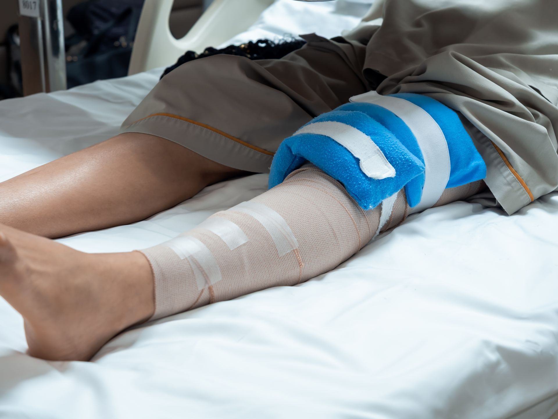 A person’s leg bandaged and resting on a hospital bed with a blue ice pack applied to the knee area.