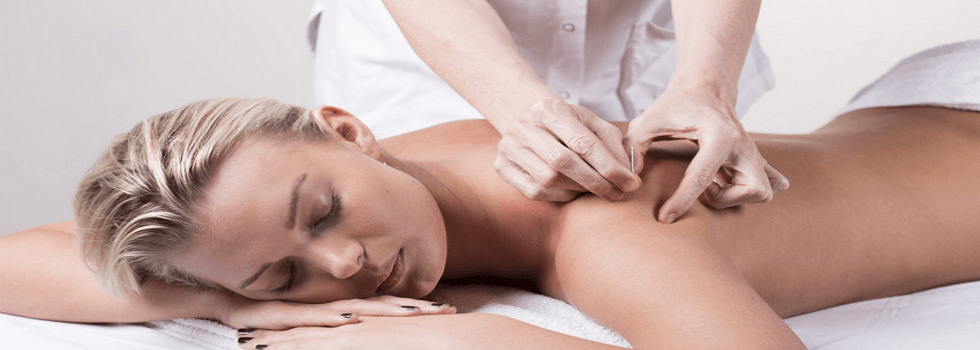 Acupuncture