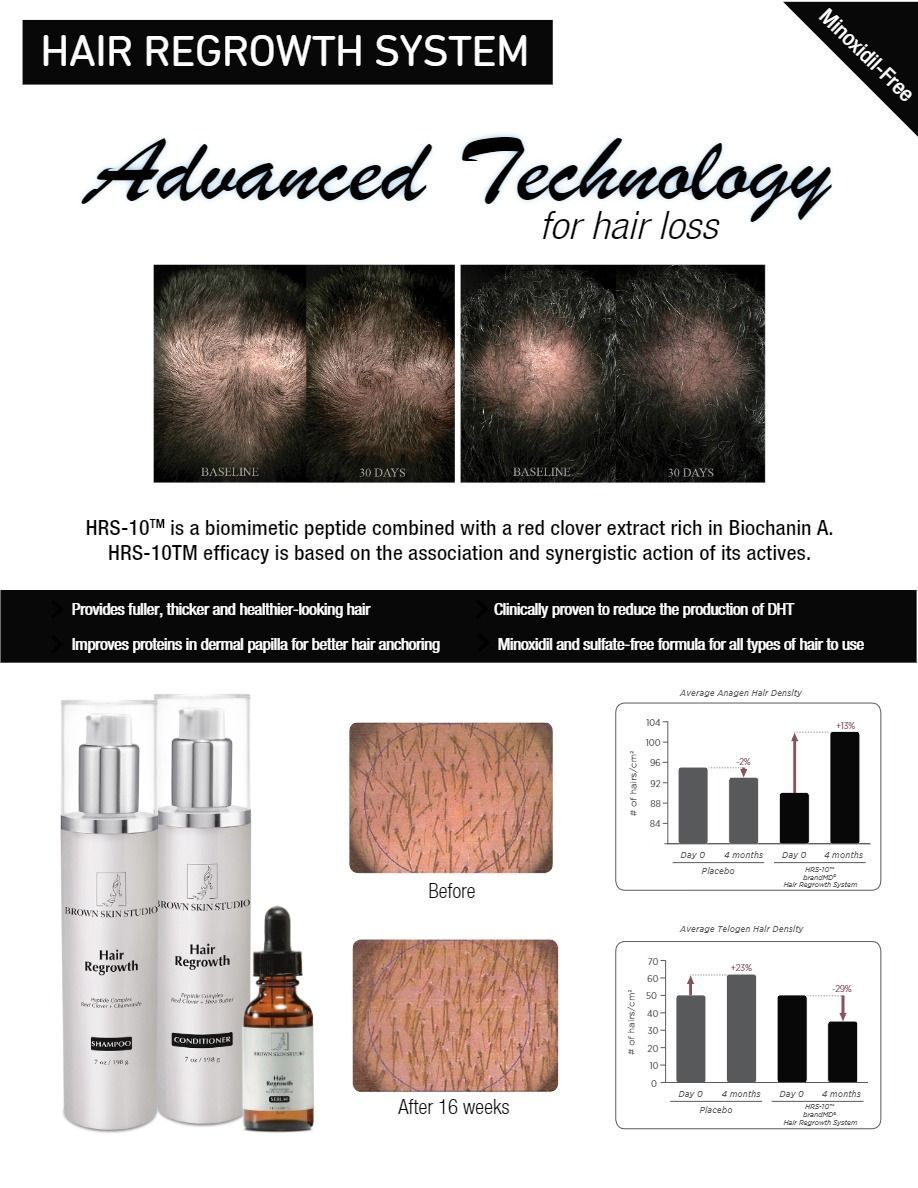  for hair regrowth system advanced technology for hair loss