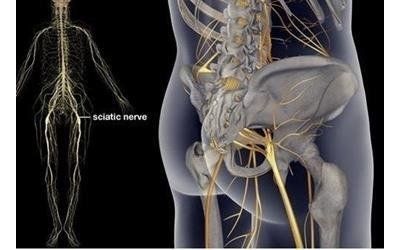 Nervo sciatico