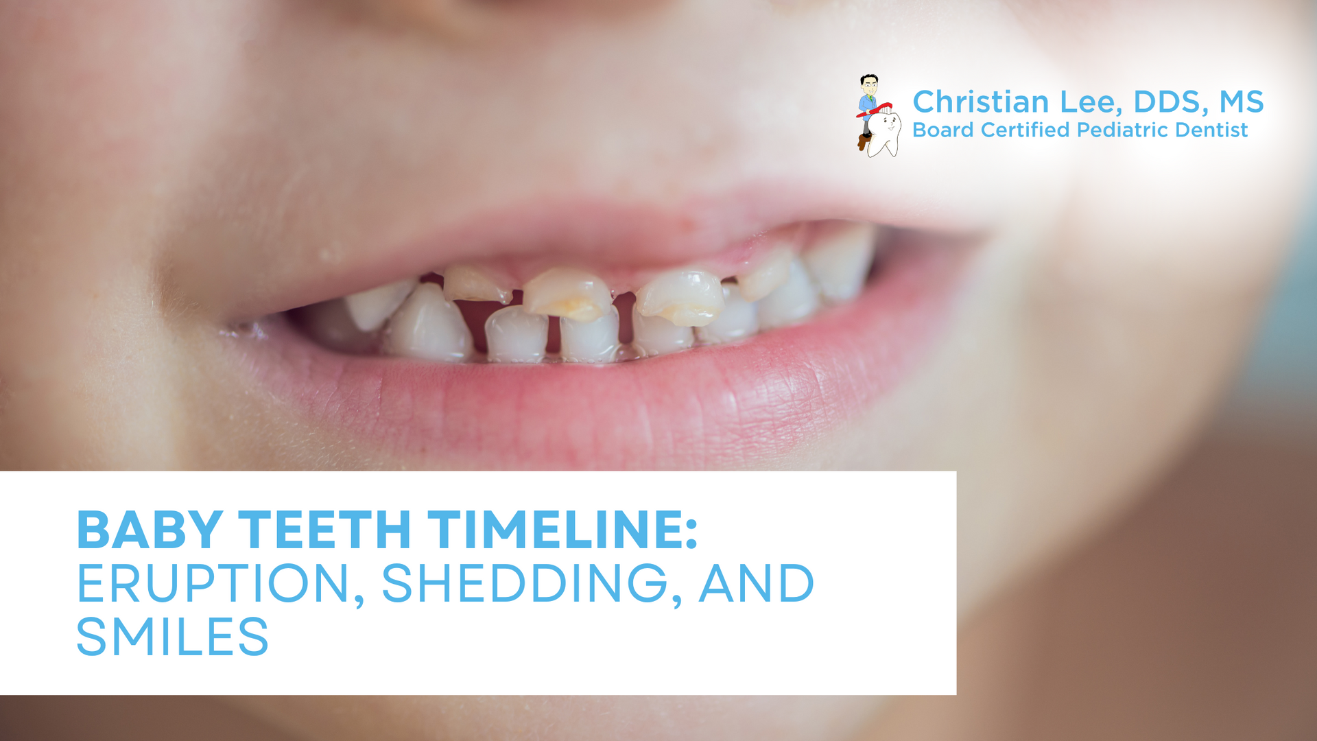 Baby teeth timeline : eruption , shedding , and smiles