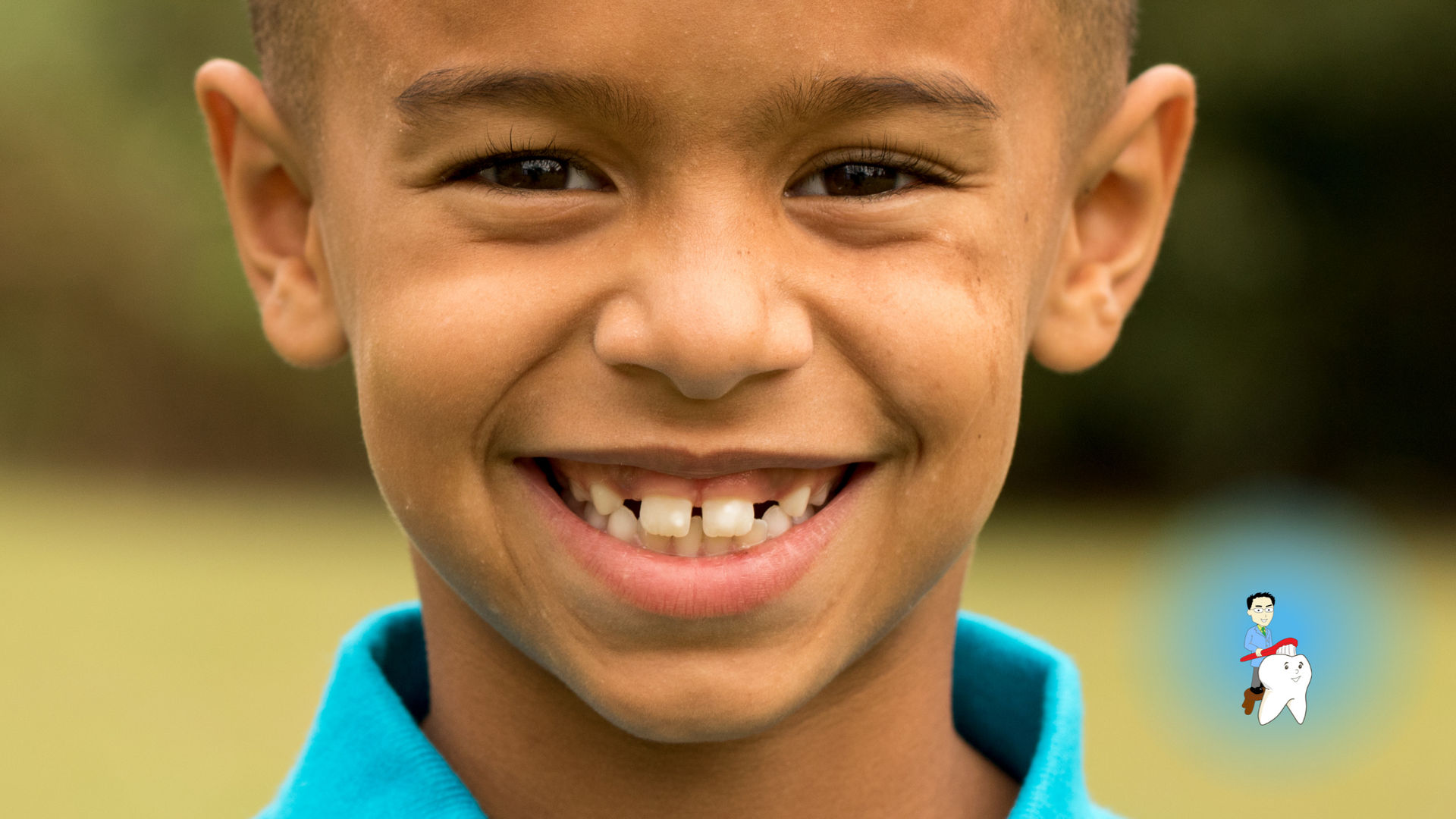 A young boy with missing teeth is smiling for the camera.