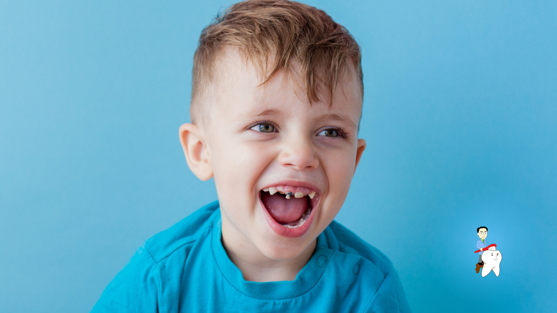 A young boy with missing teeth is laughing with his mouth open.