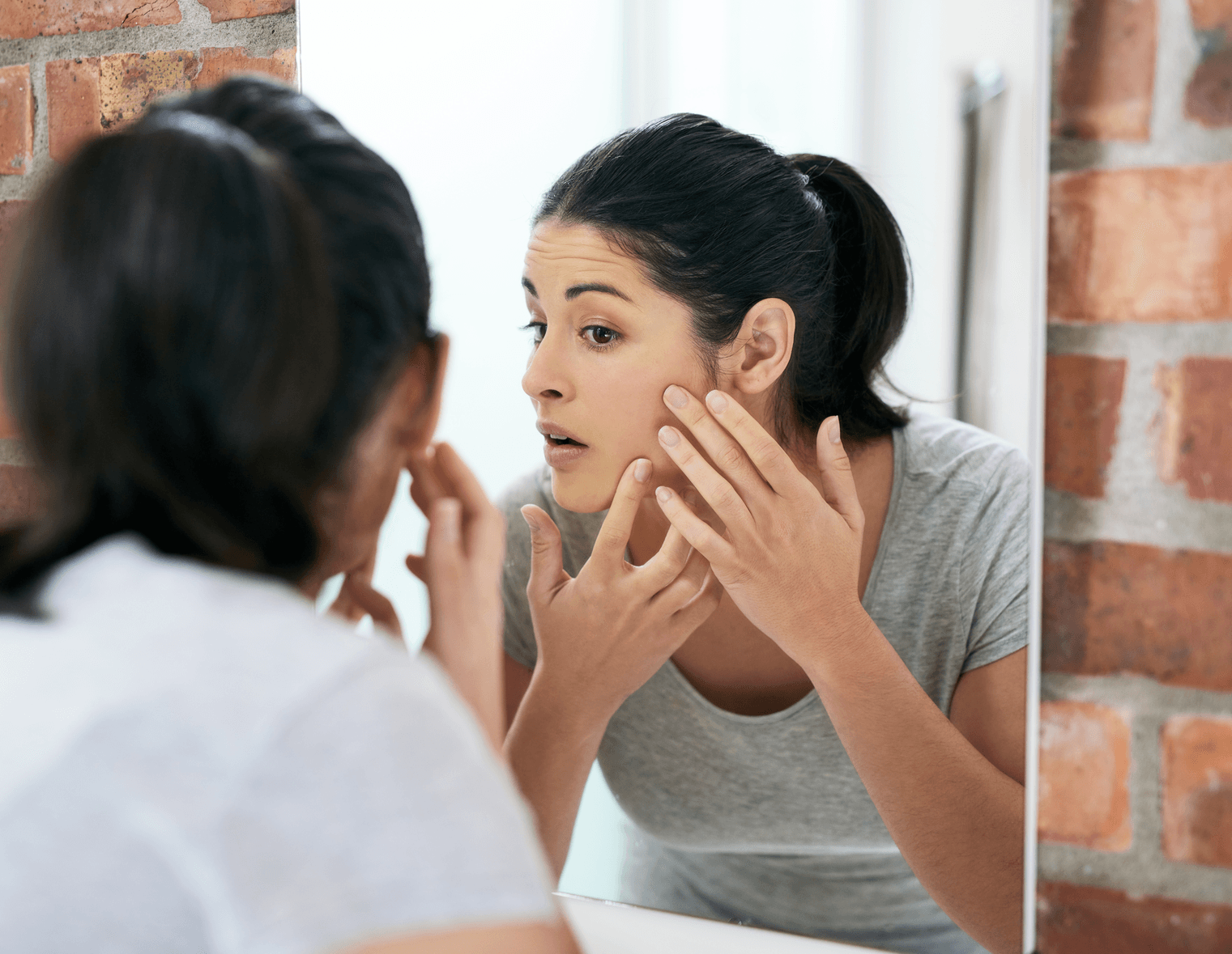 Acne Treatment at Dermatology Central Iowa