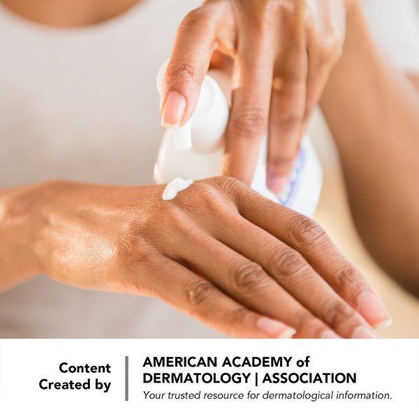 Severe Atopic Dermatitis