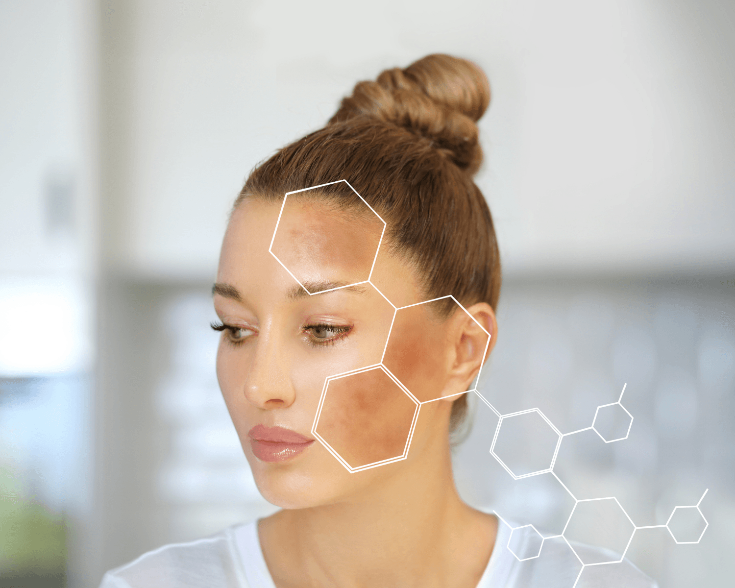 women with pigmentation issues on face