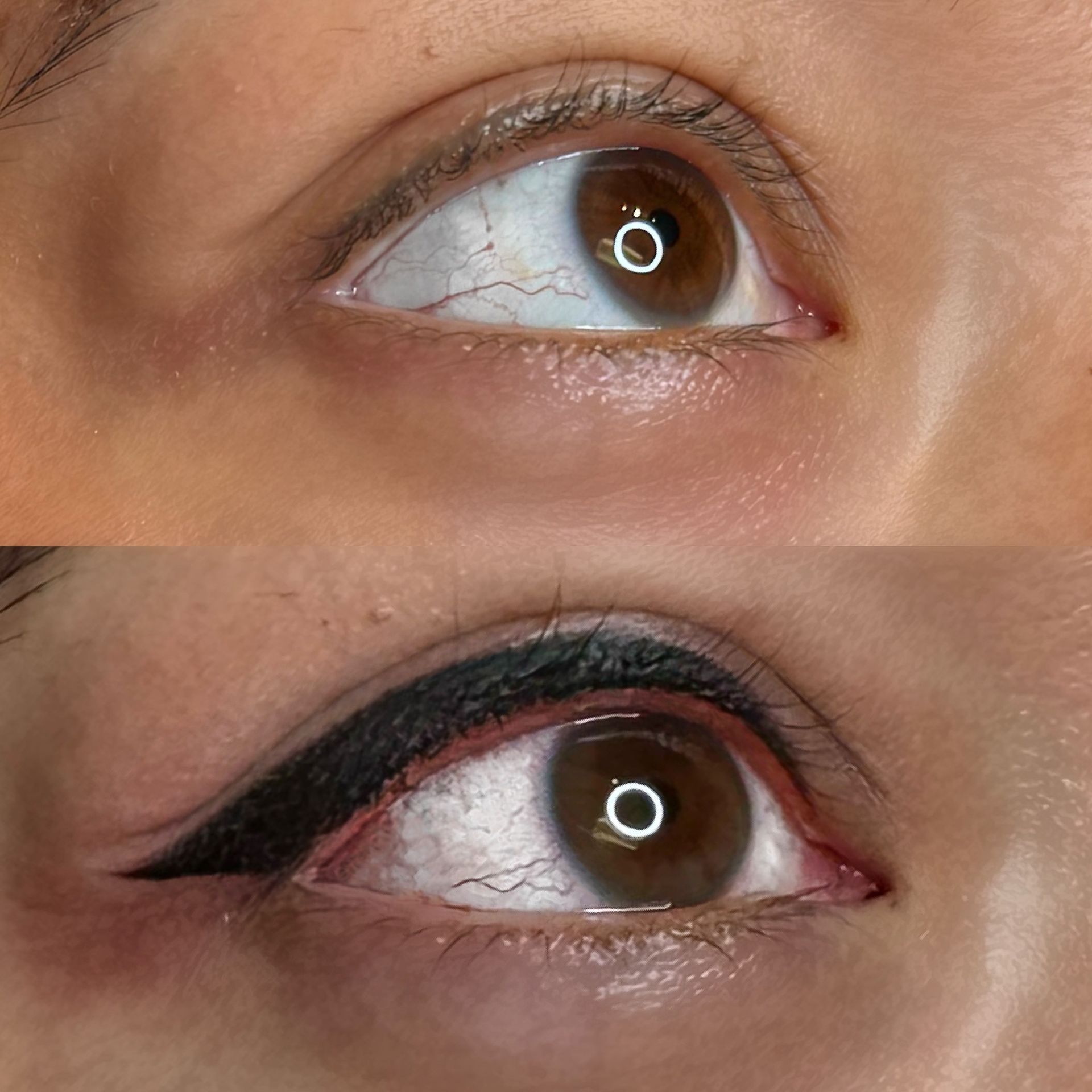 A woman is getting a treatment on her face