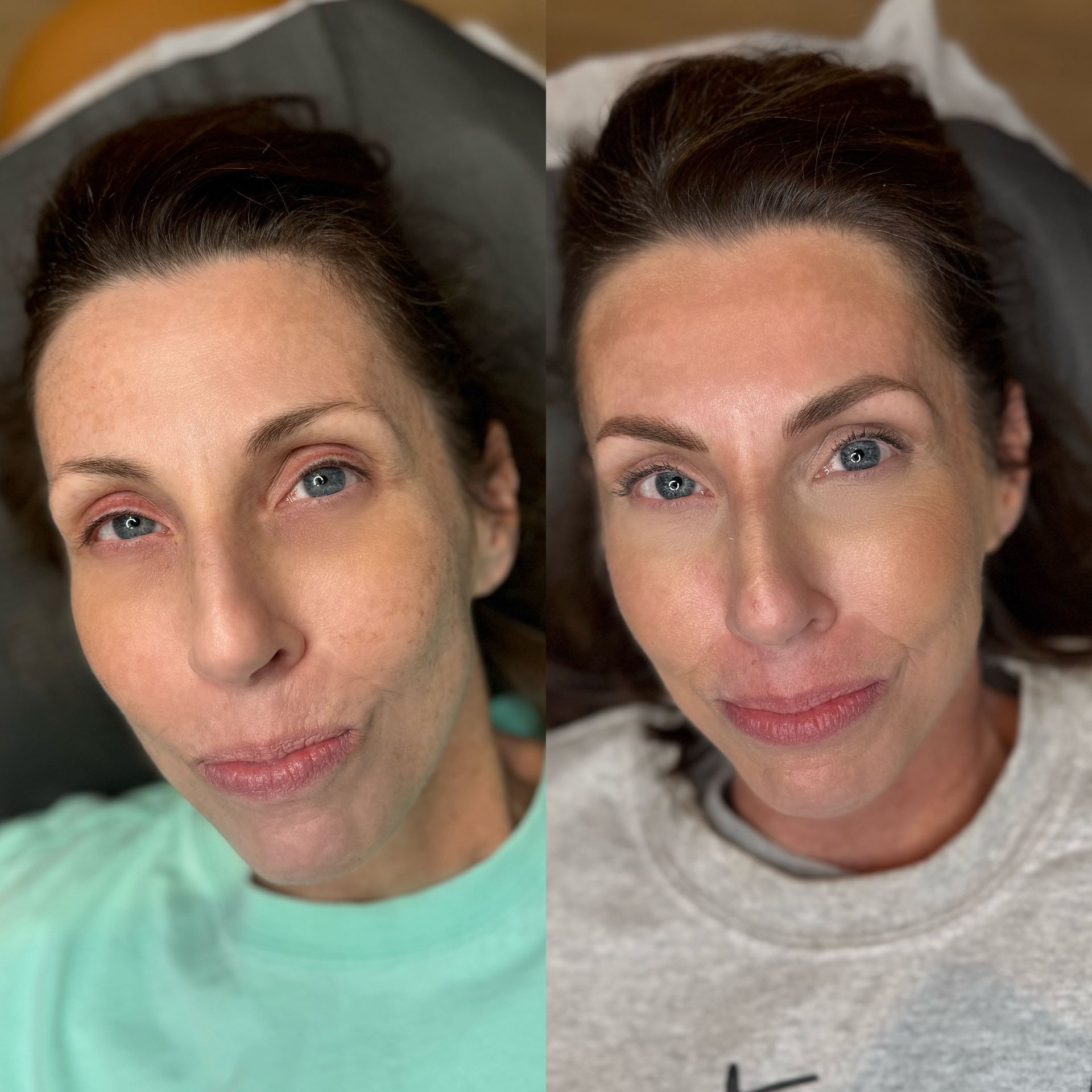 A before and after photo of a woman 's face.