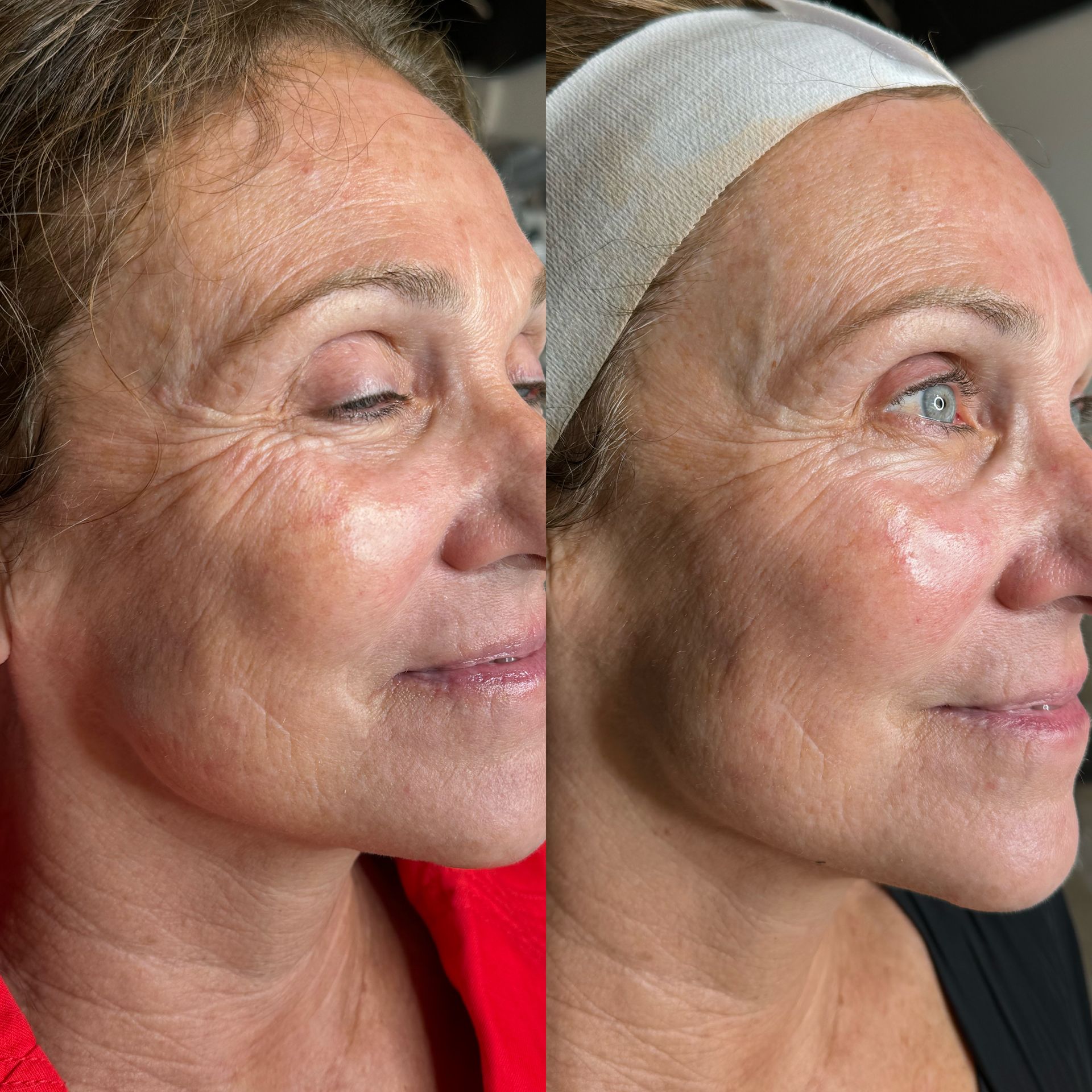 A before and after photo of a woman 's face.