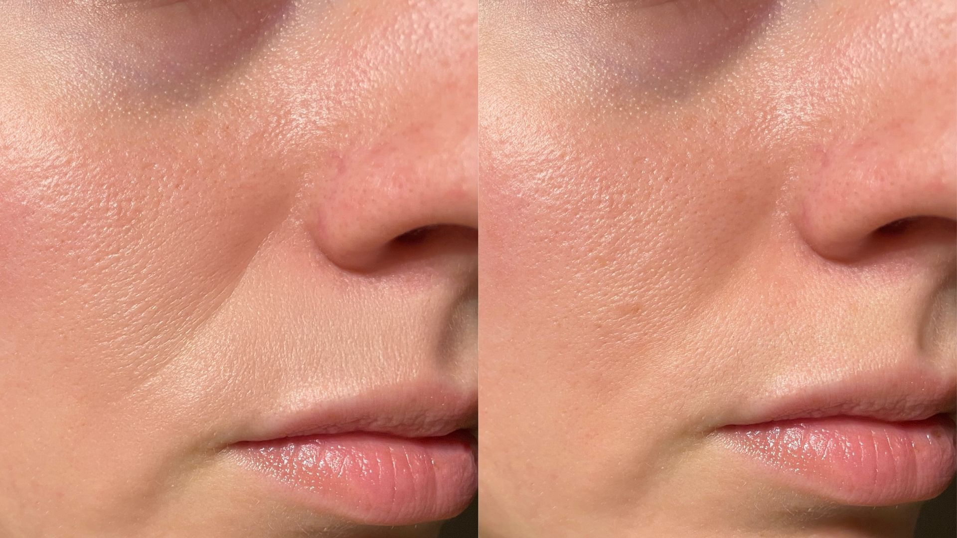 A before and after photo of a woman 's face.