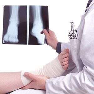 Sports Medicine — X-Ray of Injured Foot in Denville, NJ