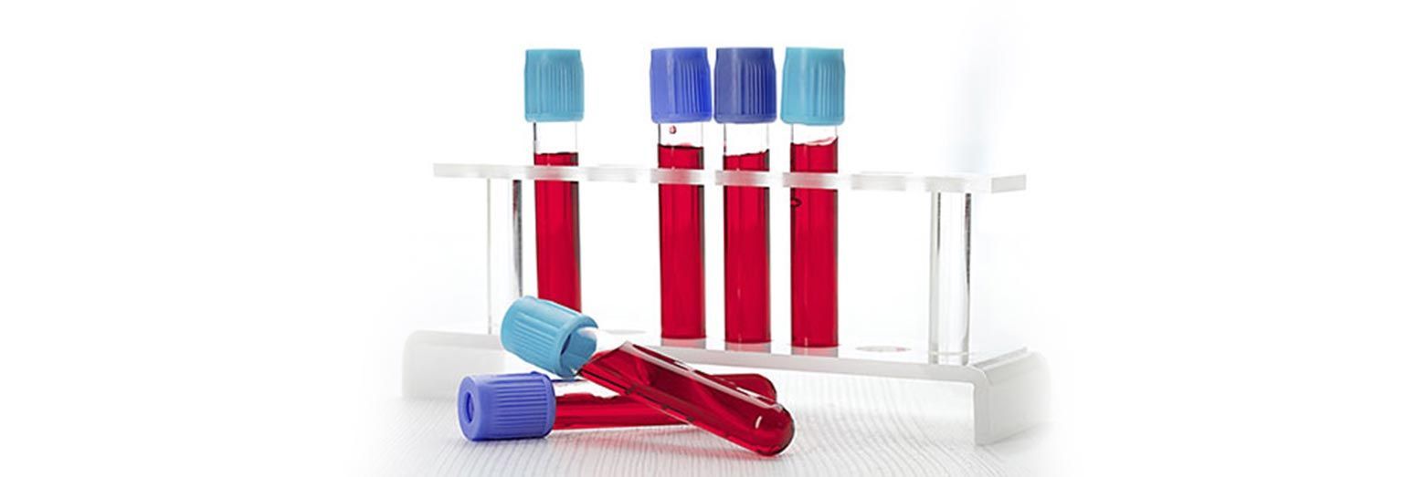 Análisis de sangre: El análisis clínico por excelencia