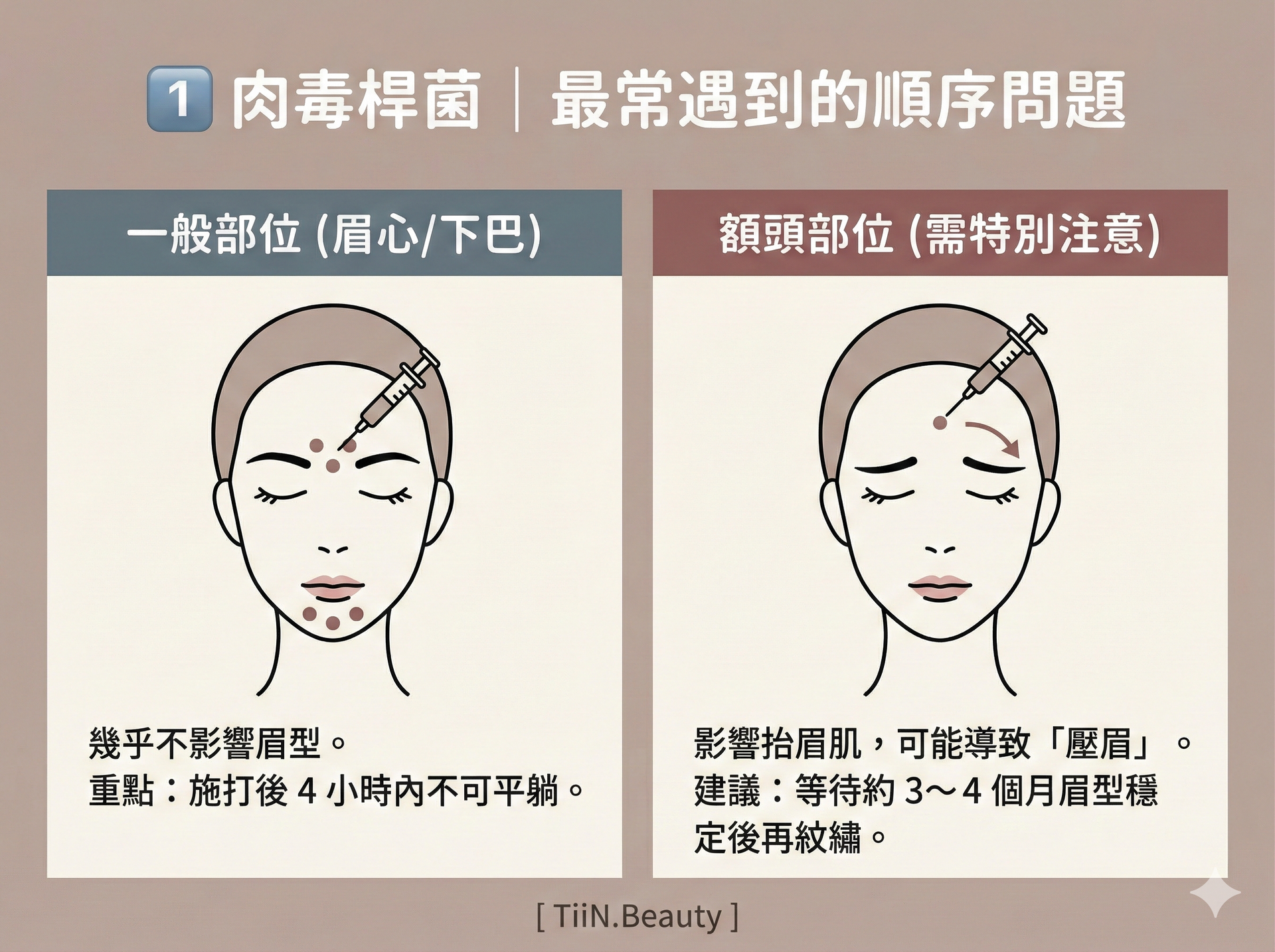 一張橫向圖表，標題為「1️⃣ 肉毒桿菌｜最常遇到的順序問題」。圖表分為兩欄，左欄「一般部位 (眉心/下巴)」展示注射示意圖，文字說明「幾乎不影響眉型。重點：施打後 4 小時內不可平躺」。右欄「額頭部位 (需特別注意)」展示注射示意圖，文字說明「影響抬眉肌，可能導致『壓眉』。建議：等待約 3～4 個月眉型穩定後再紋繡」。底部有 [ TiiN.Beauty ] 字樣。