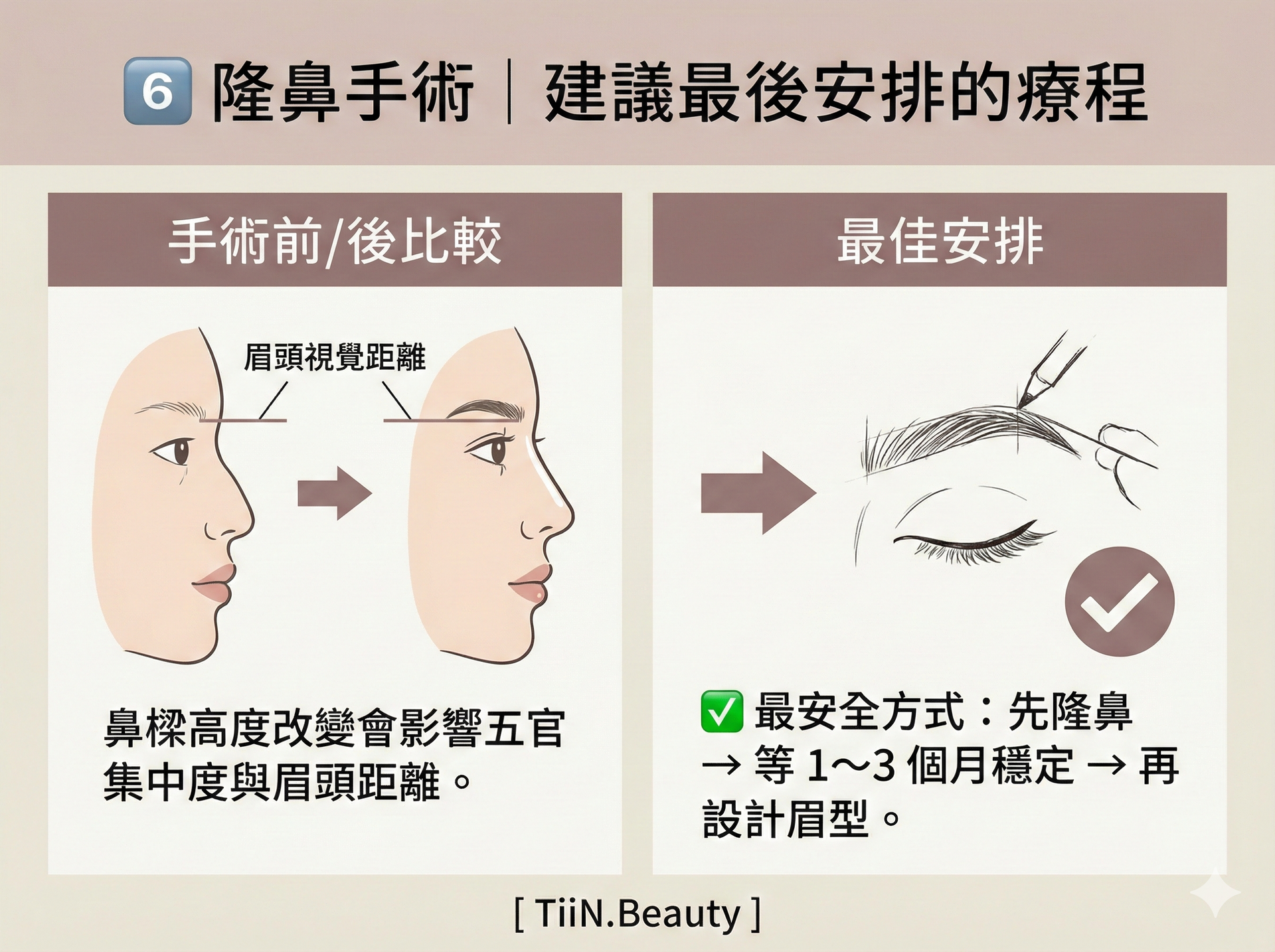 一張橫向圖表，標題為「6️⃣ 隆鼻手術｜建議最後安排的療程」。左欄「手術前/後比較」展示隆鼻手術前後的臉部側面圖，標示眉頭視覺距離的改變，文字說明「鼻樑高度改變會影響五官集中度與眉頭距離」。右欄「最佳安排」展示一個箭頭指向眉毛設計的示意圖，文字說明「✅ 最安全方式：先隆鼻 → 等 1～3 個月穩定 → 再設計眉型」。底部有 [ TiiN.Beauty ] 字樣。