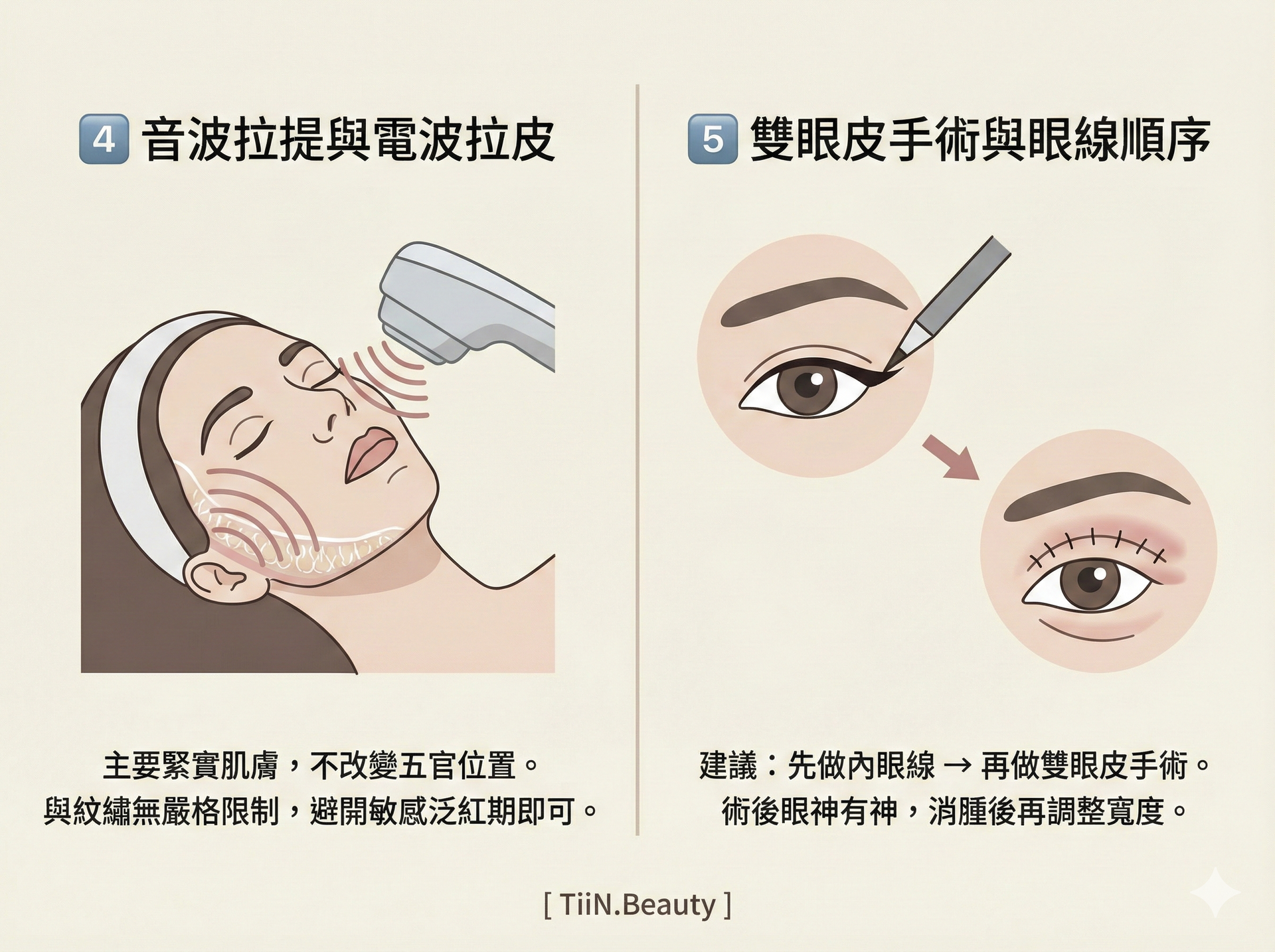一張橫向圖表，標題分為「4️⃣ 音波拉提與電波拉皮」和「5️⃣ 雙眼皮手術與眼線順序」。左欄展示音波拉提治療的示意圖，文字說明「主要緊實肌膚，不改變五官位置。與紋繡無嚴格限制，避開敏感泛紅期即可」。右欄展示先做內眼線，再進行雙眼皮手術的示意圖，文字說明「建議：先做內眼線 → 再做雙眼皮手術。術後眼神有神，消腫後再調整寬度」。底部有 [ TiiN.Beauty ] 字樣