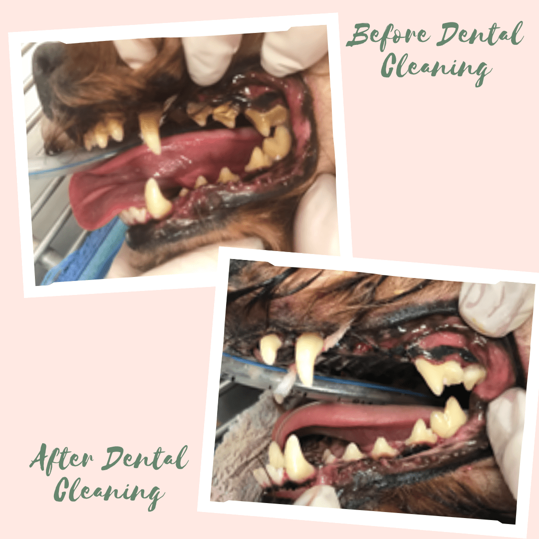 Before and After Dental Cleaning