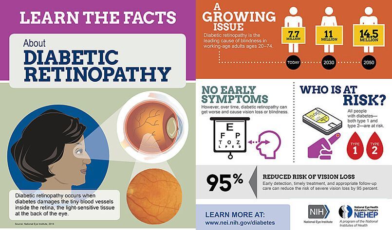 Infographic about diabetic retinopathy with facts, figures, and risk factors.