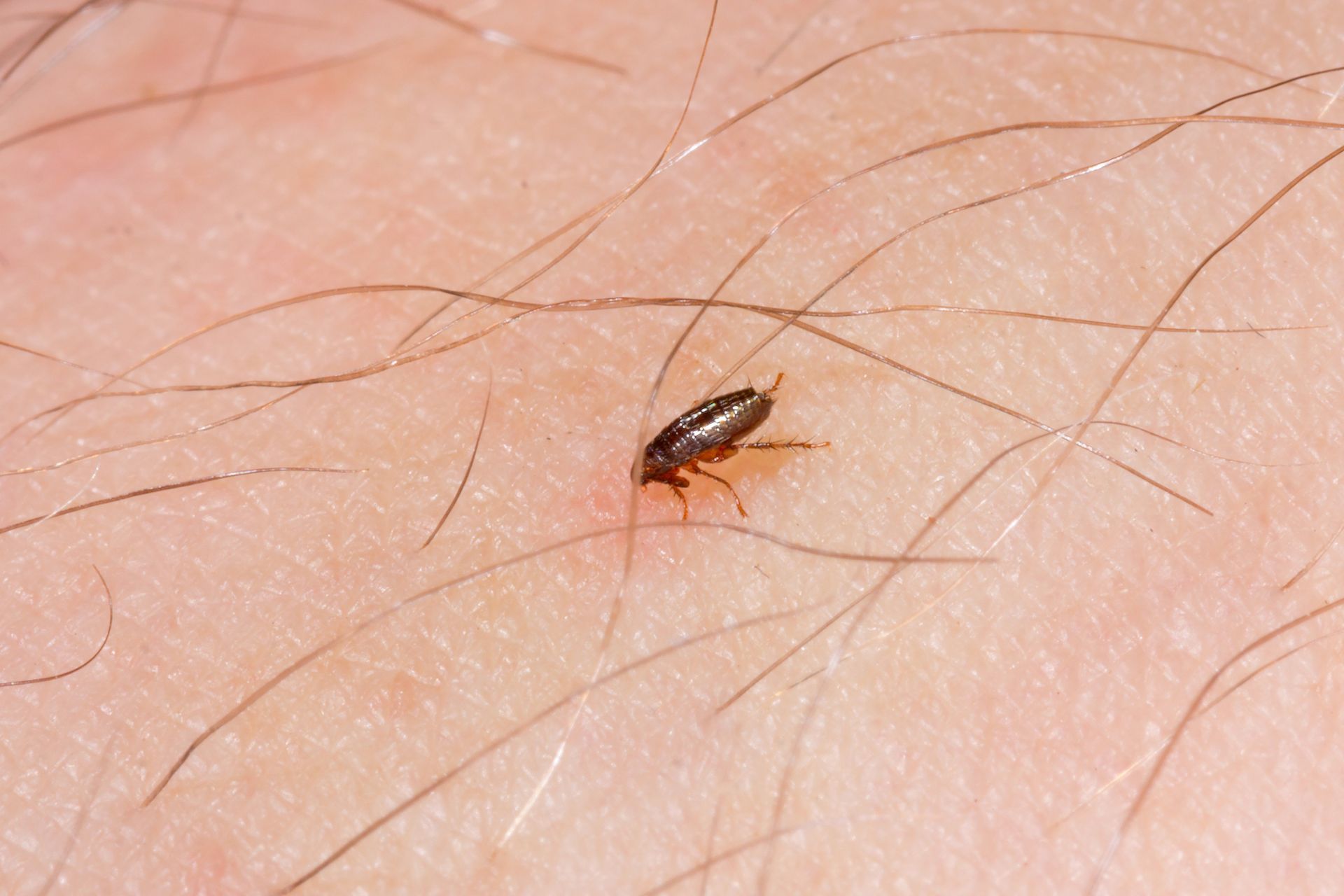 image of a flea on a human