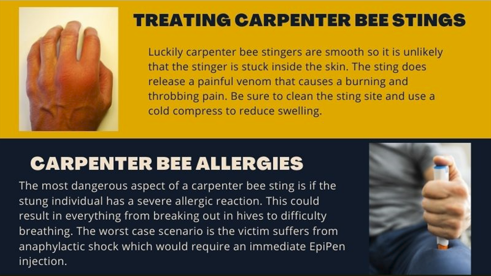 What you should do when you are stung by a carpenter bee, especially if you are allergic to bee stings.
