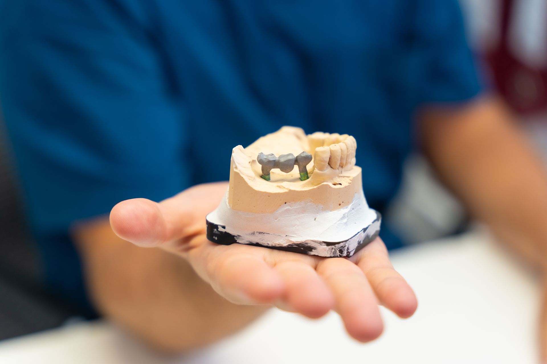 a dentist is holding a model of a dental implant in their hand.