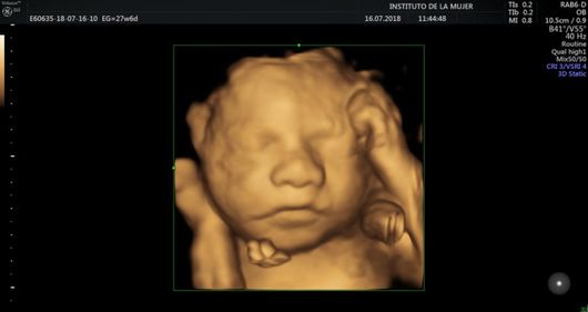 Rostro de bebé en ultrasonido