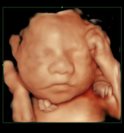 rostro de feto