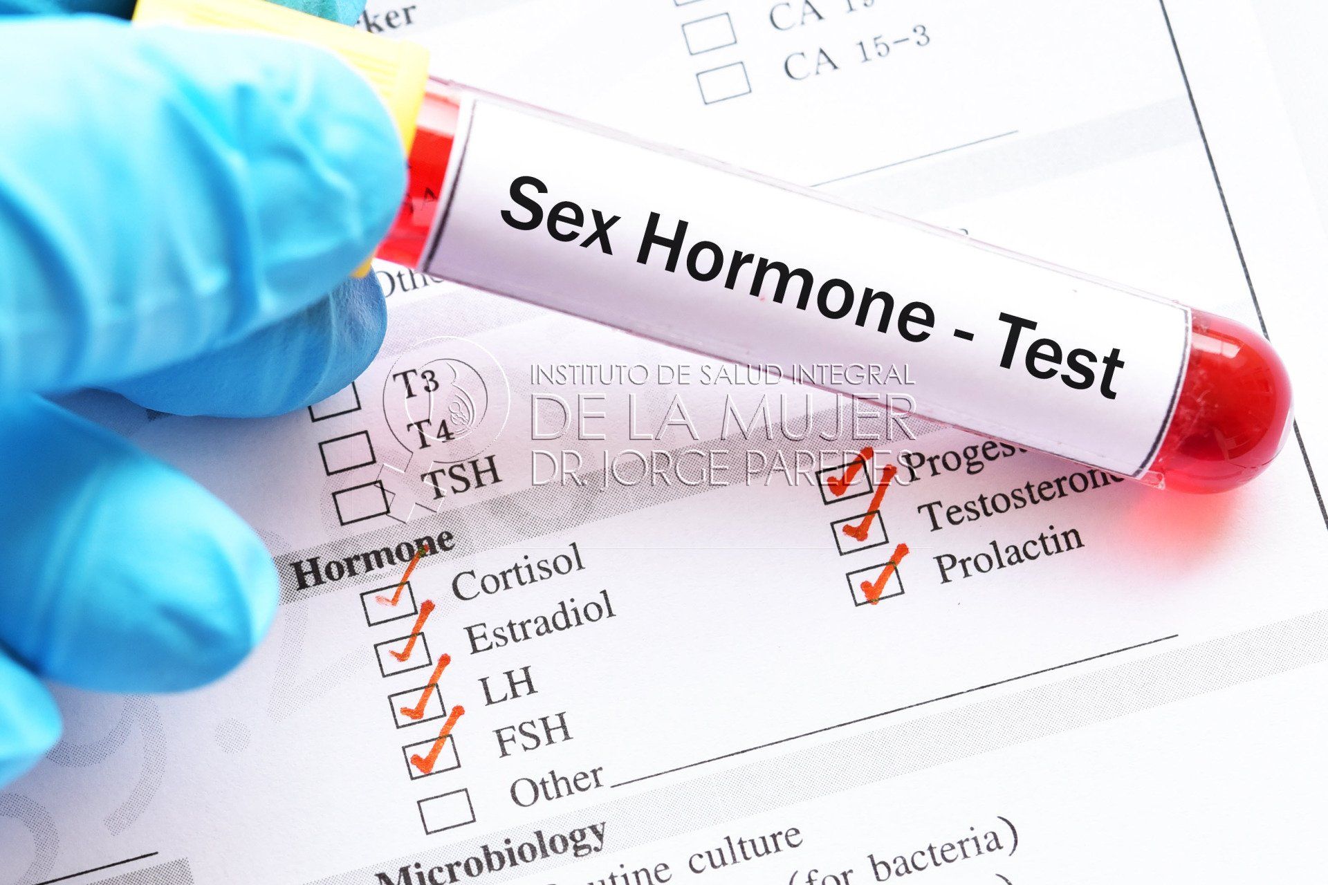 tubo de ensayo con una muestra para test de hormonas sexuales