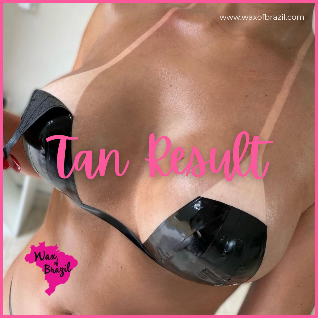 Tanned woman's chest with tan lines from bikini top; black tape is still on.