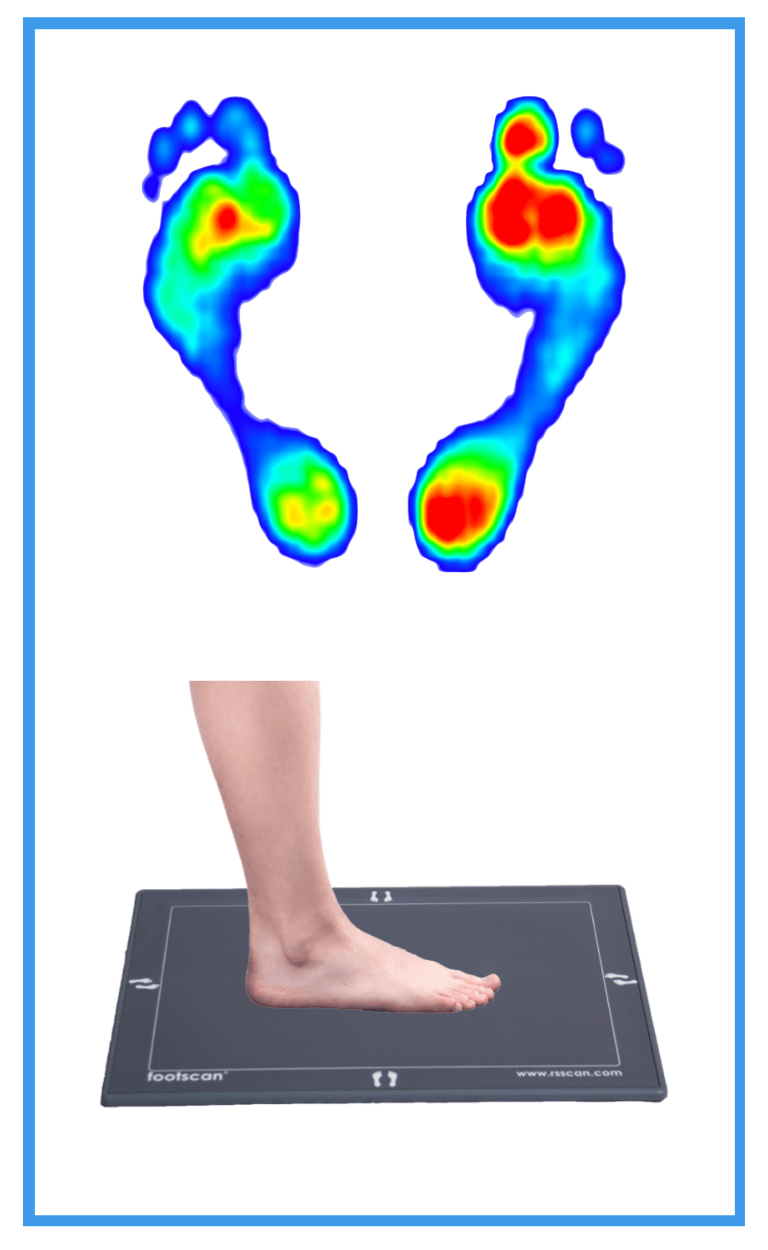 Biomechanical assessment footscan
