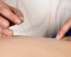 traditional pain treatments