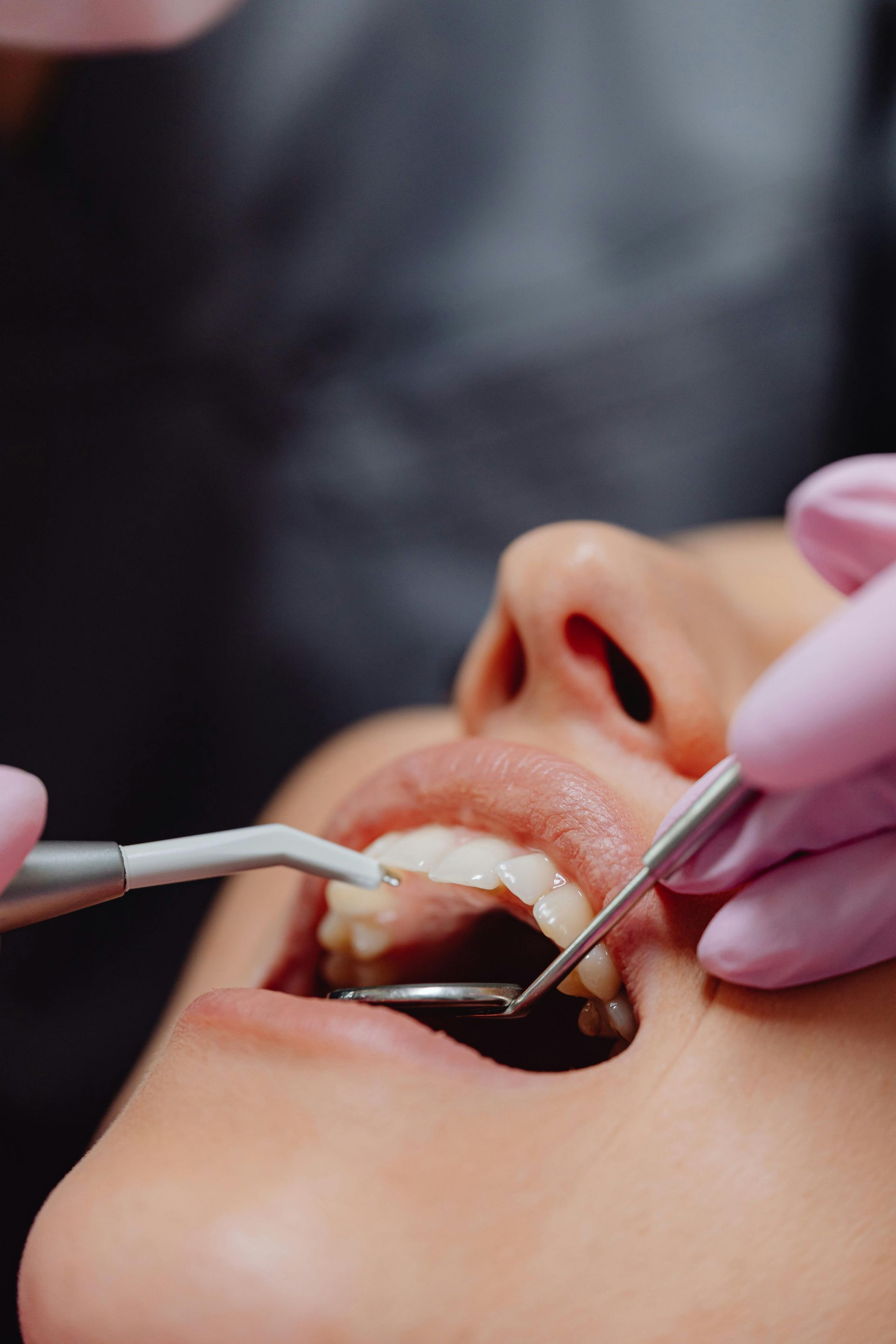Dentist's tools in a person's open mouth. Pink-gloved hands are holding tools, examining teeth during a dental checkup.