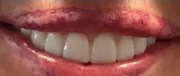 Close-up of a smiling mouth with white teeth and red lipstick.