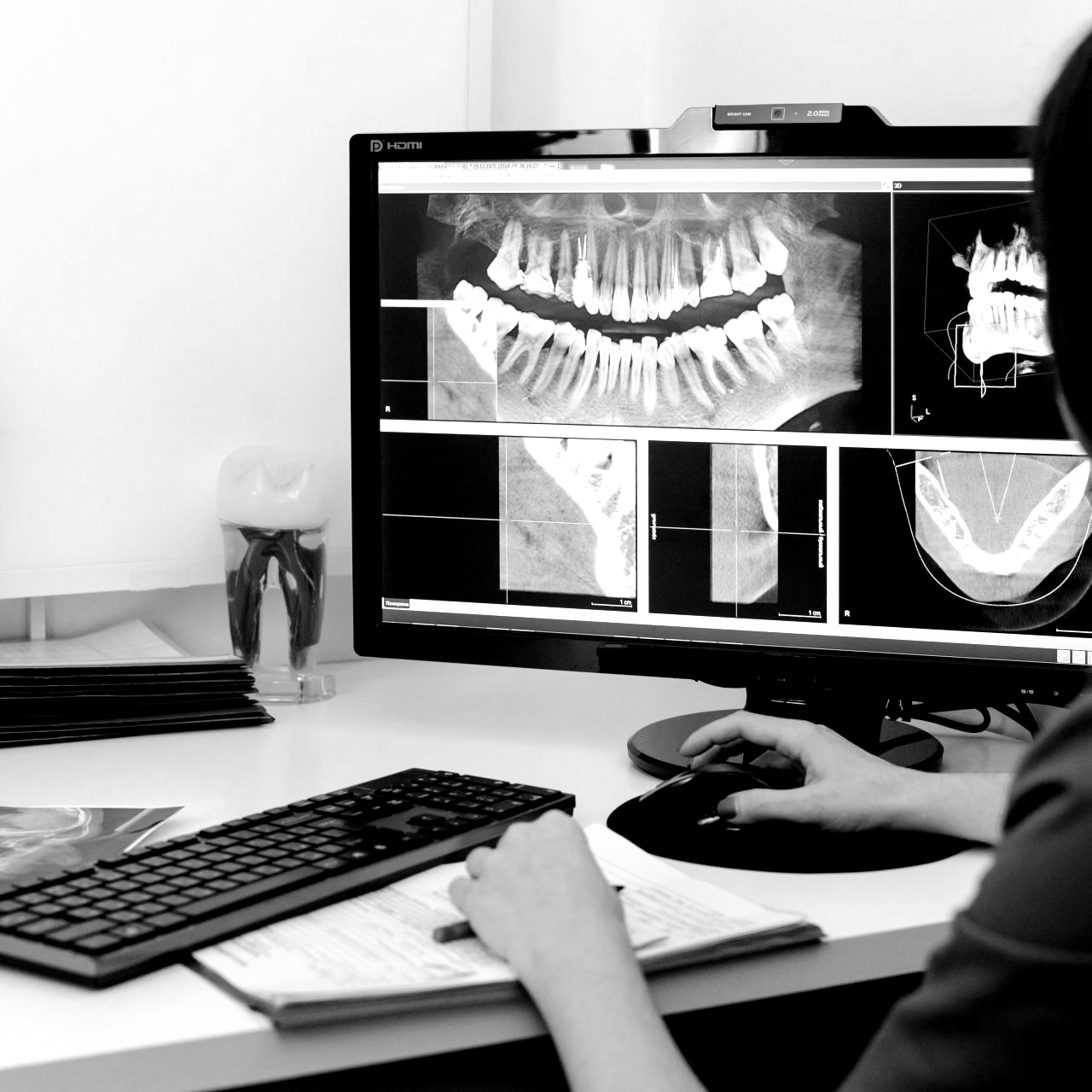 DIGITAL X-RAYS | Best family dentist for annual dental check ups and digital x rays