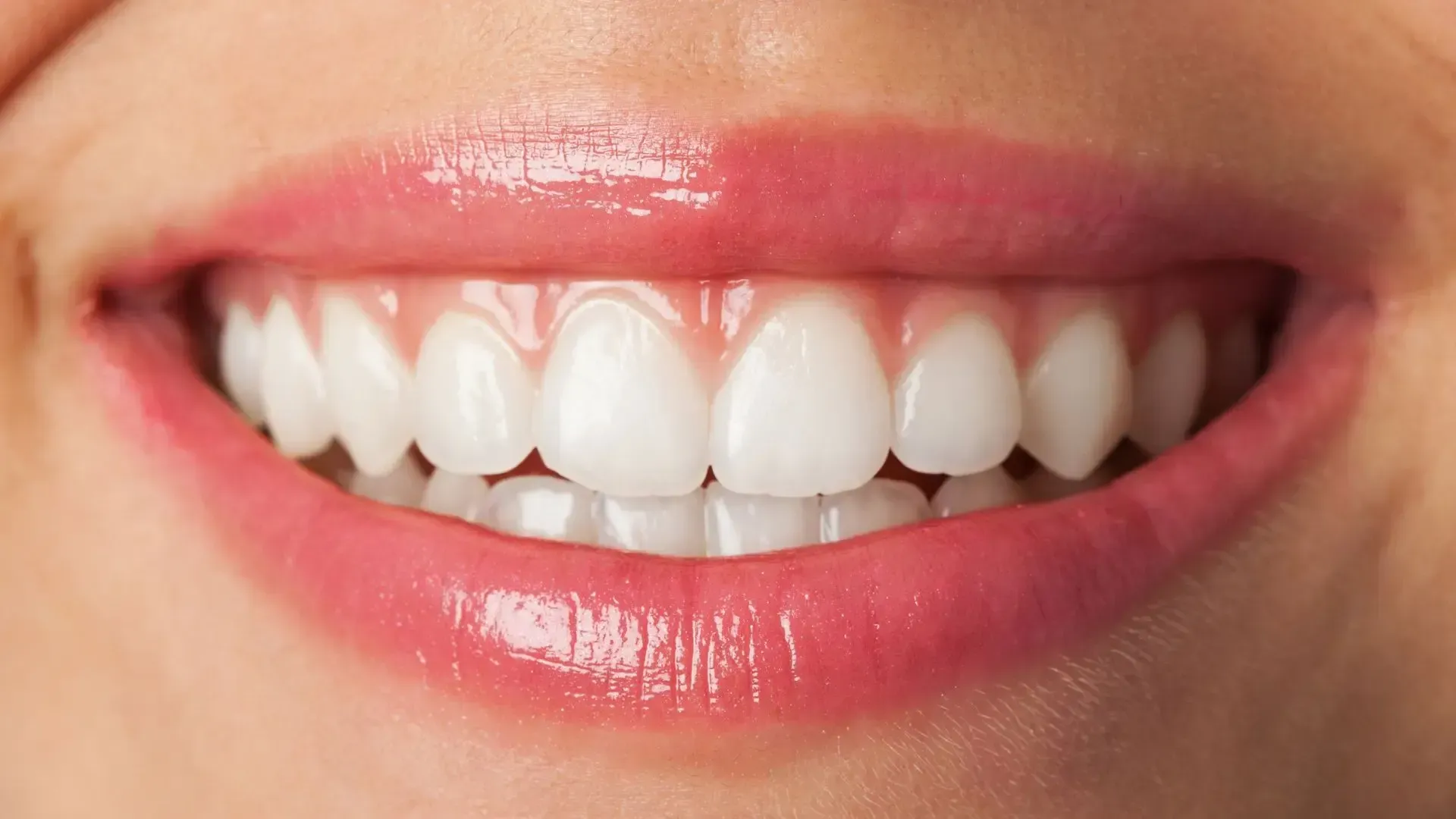 Close-up of a smiling mouth with perfect, white teeth and glossy pink lips.