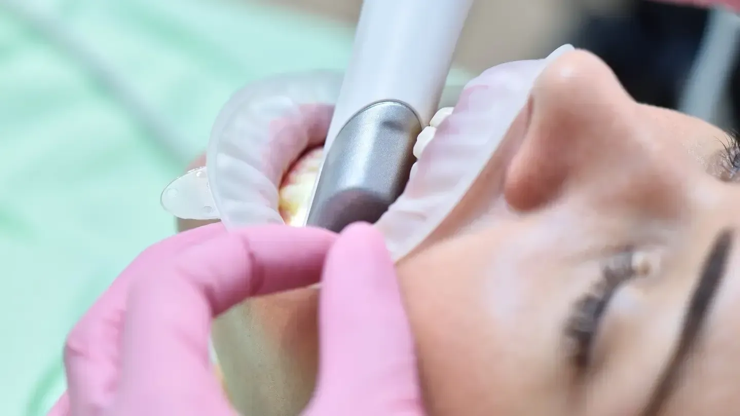 A dentist using a dental tool on a patient's teeth. The patient's mouth is open, and the dentist wears pink gloves.