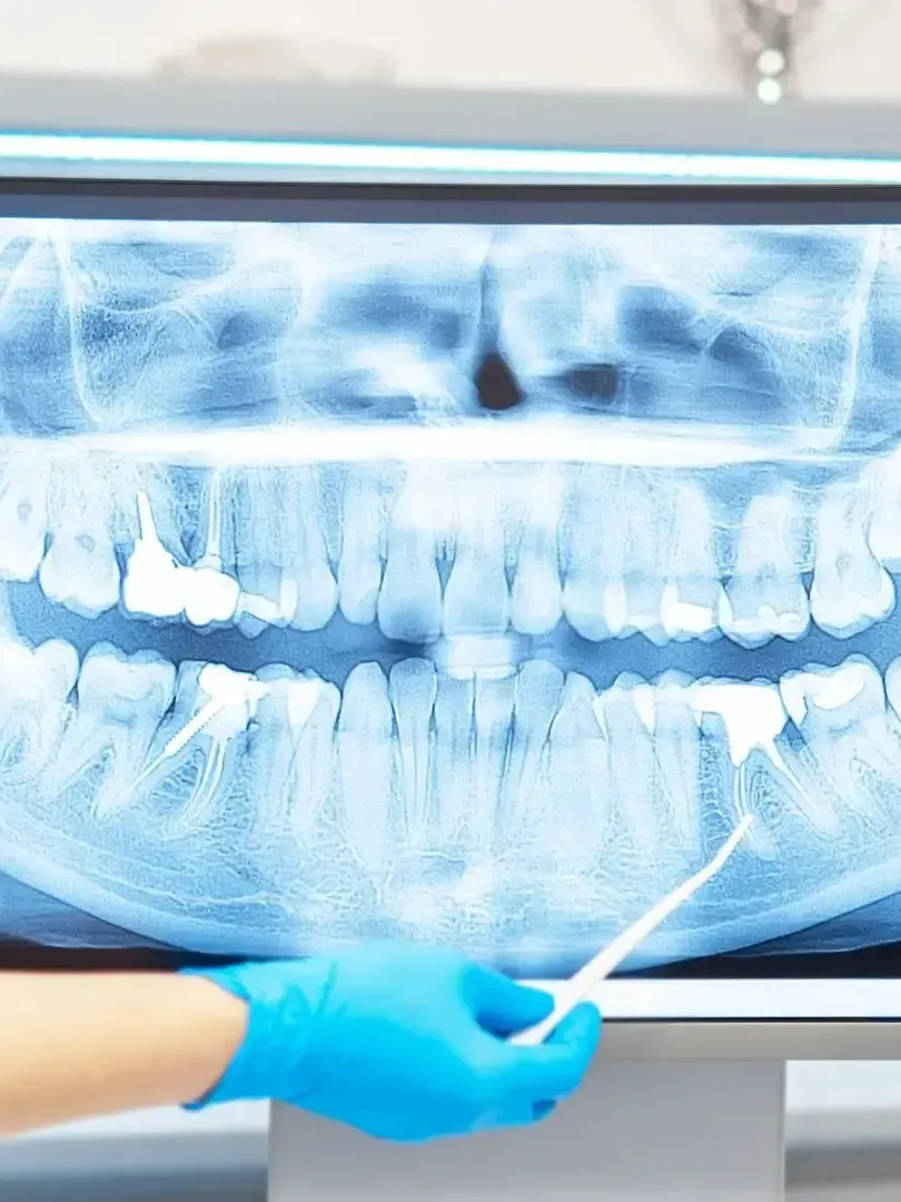 A person is holding a toothbrush in front of an x-ray of a person 's teeth.