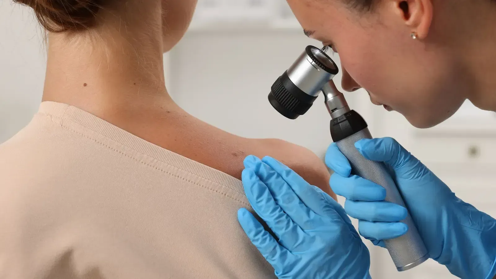 Doctor examining a patient's shoulder with a dermatoscope; medical setting.