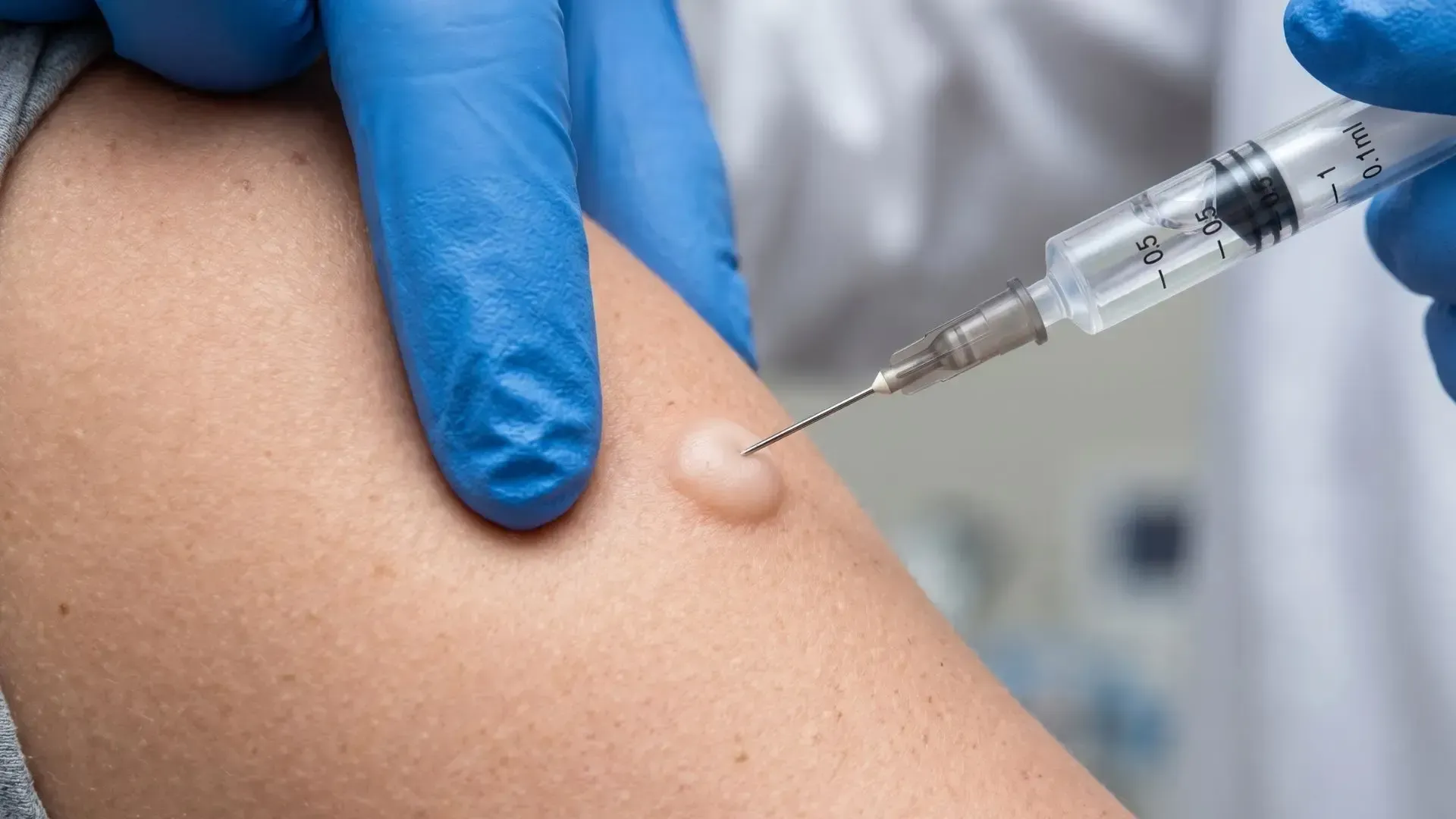 Gloved hand holding arm while a syringe injects into the upper arm