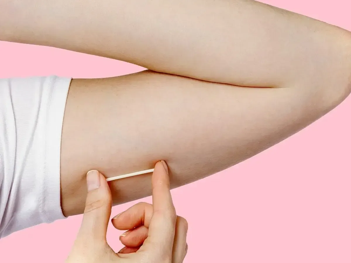 Arm with a contraceptive implant visible beneath the skin, held between two fingers against a pink background.