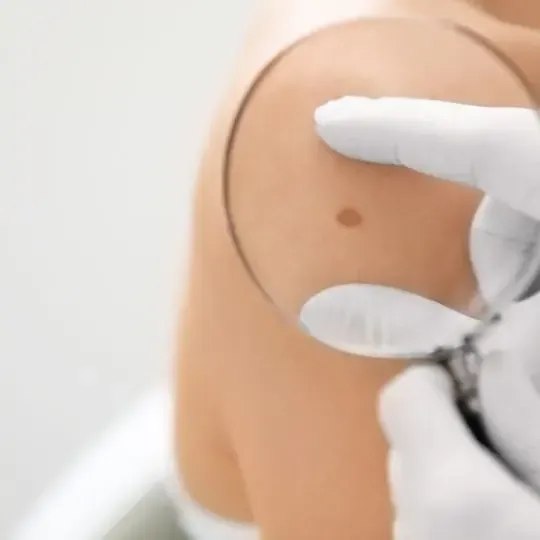 A close up of a person 's arm with a white glove on