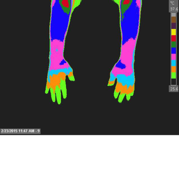 A thermal image of a person 's hands and feet
