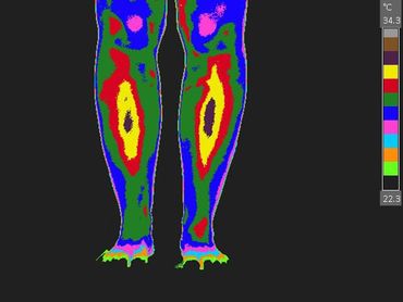 A thermal image of a person 's legs and feet.